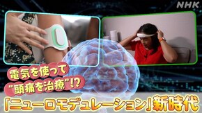 電気を使って“頭痛治療”!?ニューロモデュレーション新時代