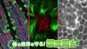 体の秩序を守る!“細胞競合”研究最前線