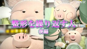 整形を繰り返す人・後編