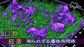 「“口腔細菌” 知られざる運命共同体」