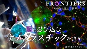 脳に忍び込むナノプラスチックを追う