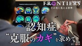 認知症“克服のカギ”を求めて